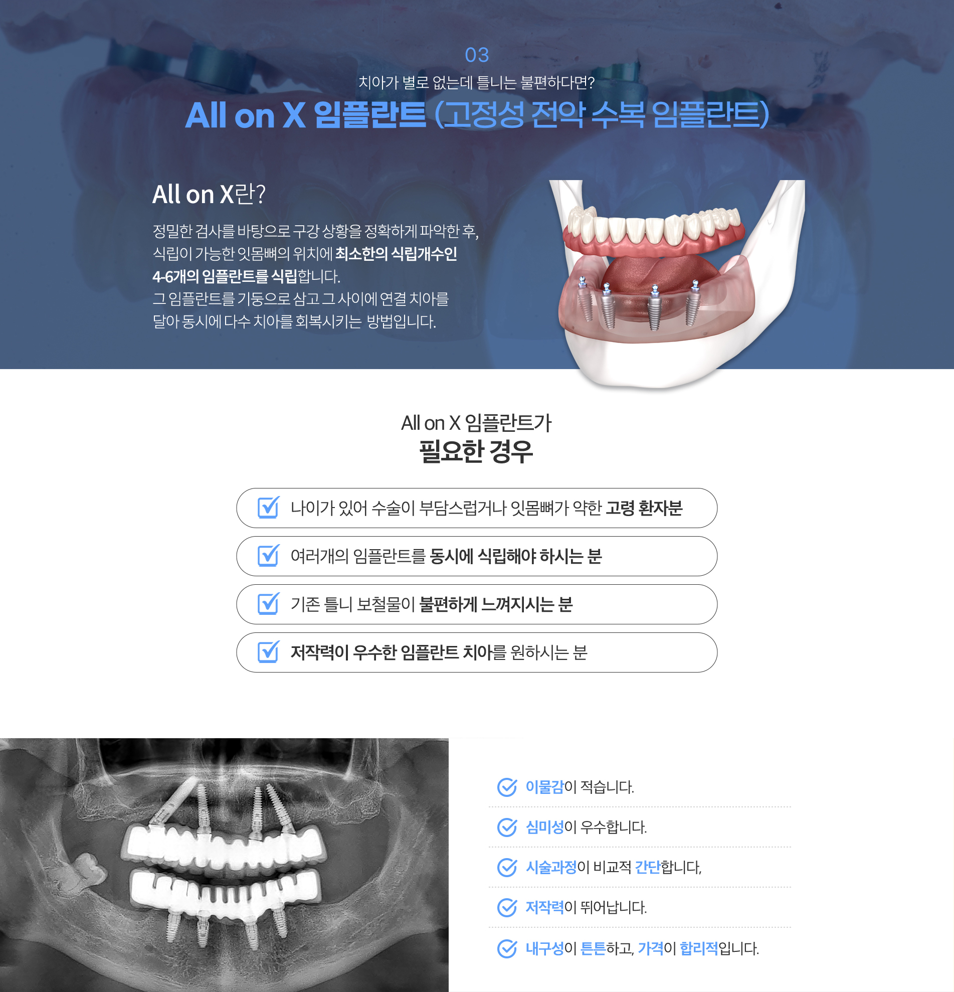 03.올온엑스 임플란트