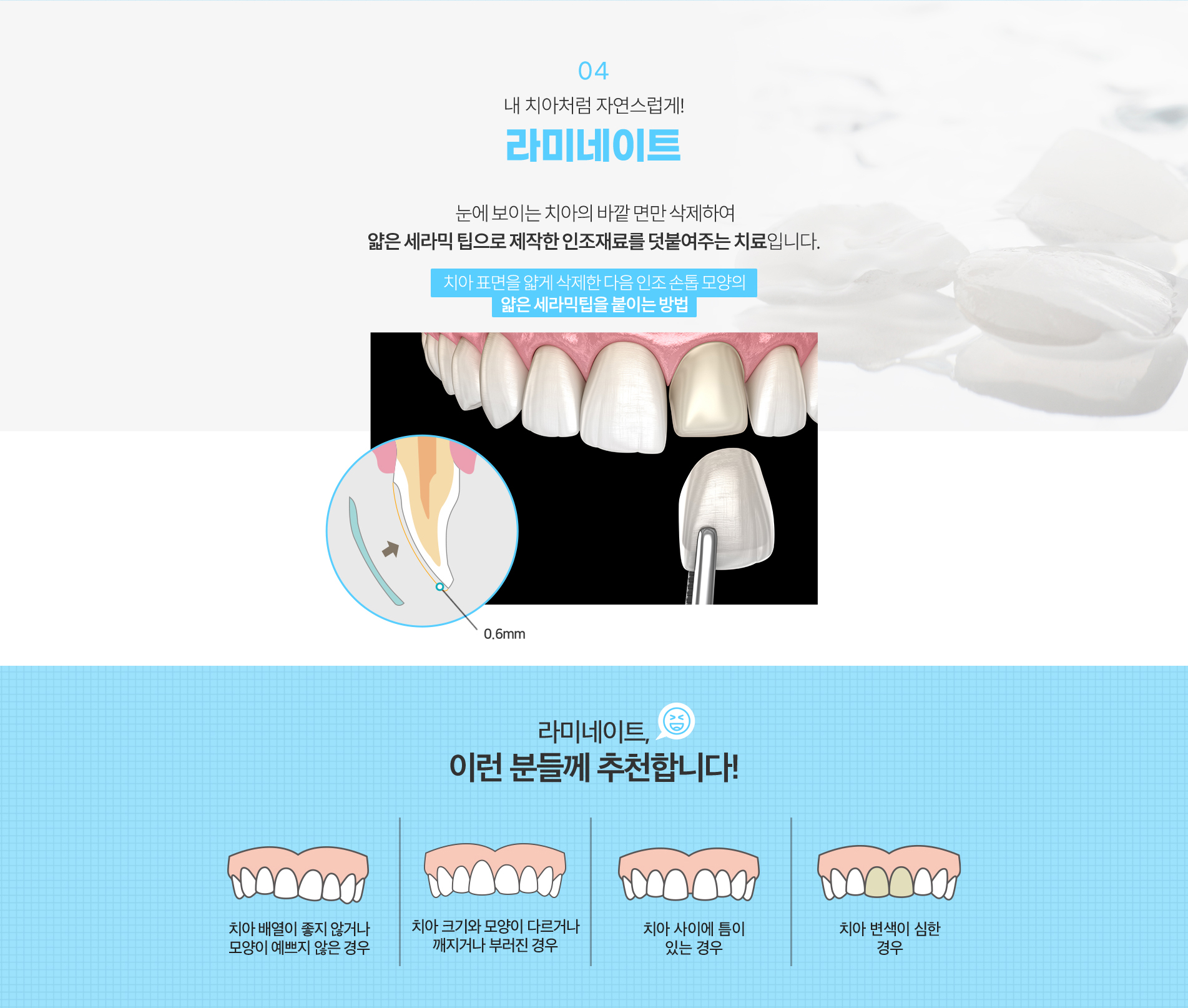 04.라미네이트